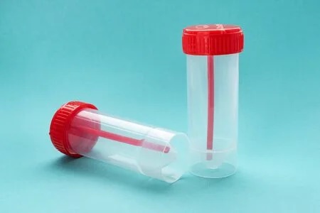 Urine
